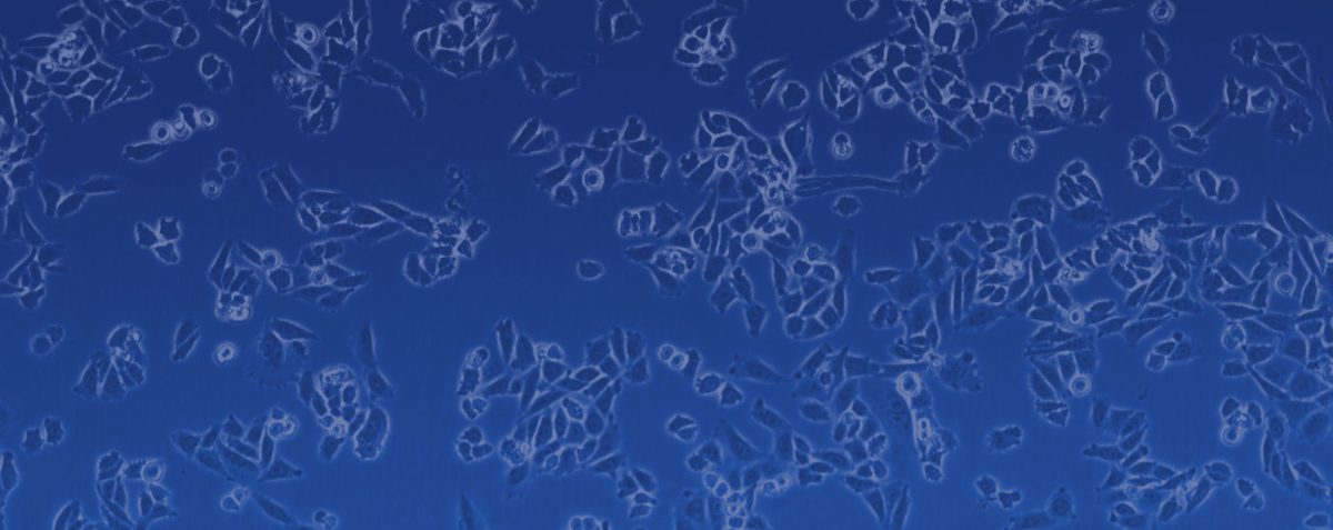 Cells imaged for analysis